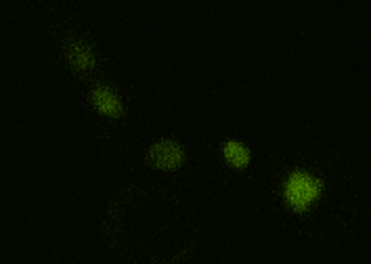 Cells - Spatio Temporal Simulation